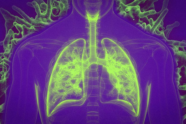 Vaccination by Inhalation – Boosts Immune Responses to Respiratory Infections and Lung Cancer